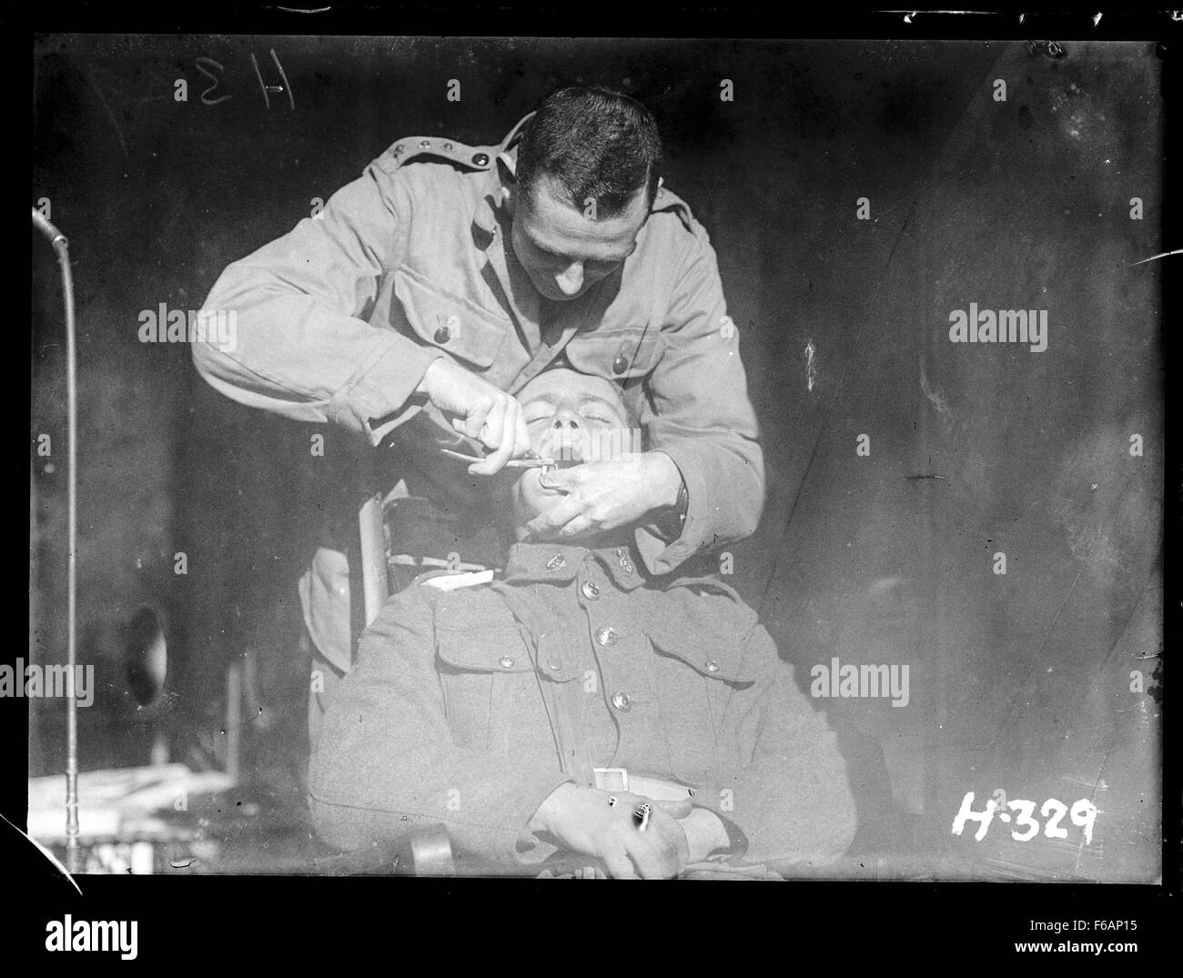 Dieses Foto zeigt einen Soldaten aus dem Ersten Weltkrieg, der sich einer Zahnentfernung unterzieht. Es spiegelt die Not wider, denen Soldaten gegenüberstehen, einschließlich medizinischer Behandlungen auf dem Schlachtfeld. Das Bild zeigt den körperlichen und emotionalen Tribut des Krieges an den Soldaten. Stockfoto