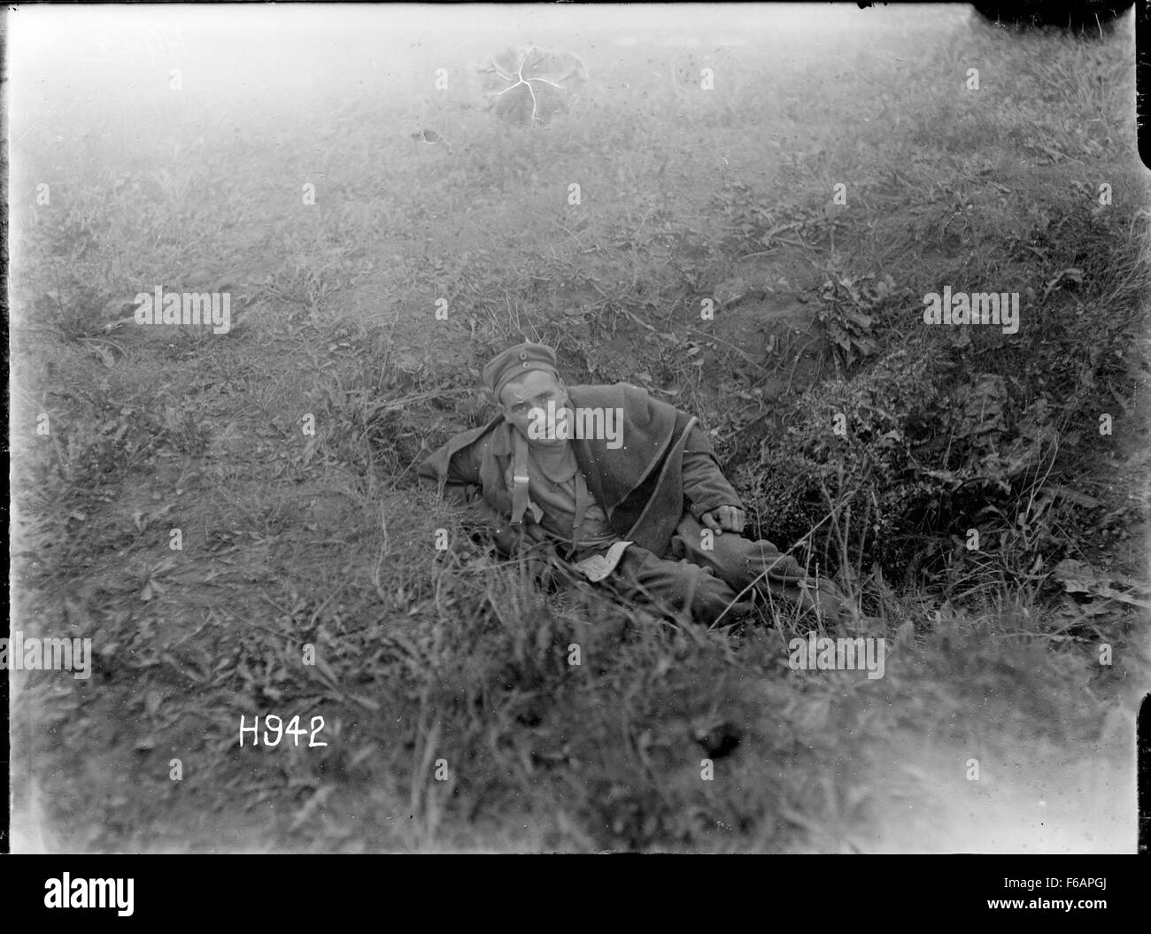 Diese historische Fotografie zeigt einen deutschen Soldaten als Kriegsgefangenen, der bei Grevillers, einem Ort in Nordfrankreich, verwundet und gefangen genommen wurde. Es bietet einen feierlichen Einblick in die menschlichen Kosten der Kriegsführung während des Ersten Weltkriegs Stockfoto