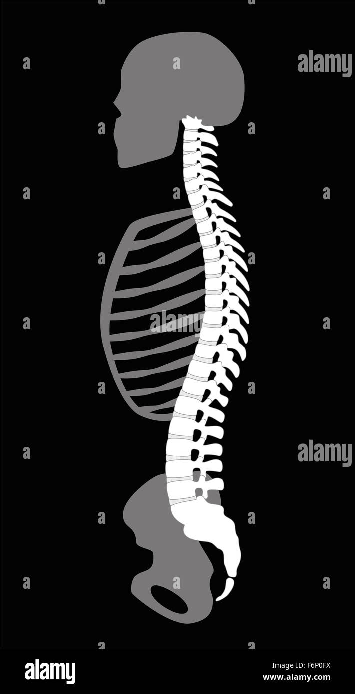 Oberkörper-Skelett mit Rückgrat, Schädelknochen, Rippen und Becken - Seitenansicht. Darstellung auf schwarzem Hintergrund. Stockfoto