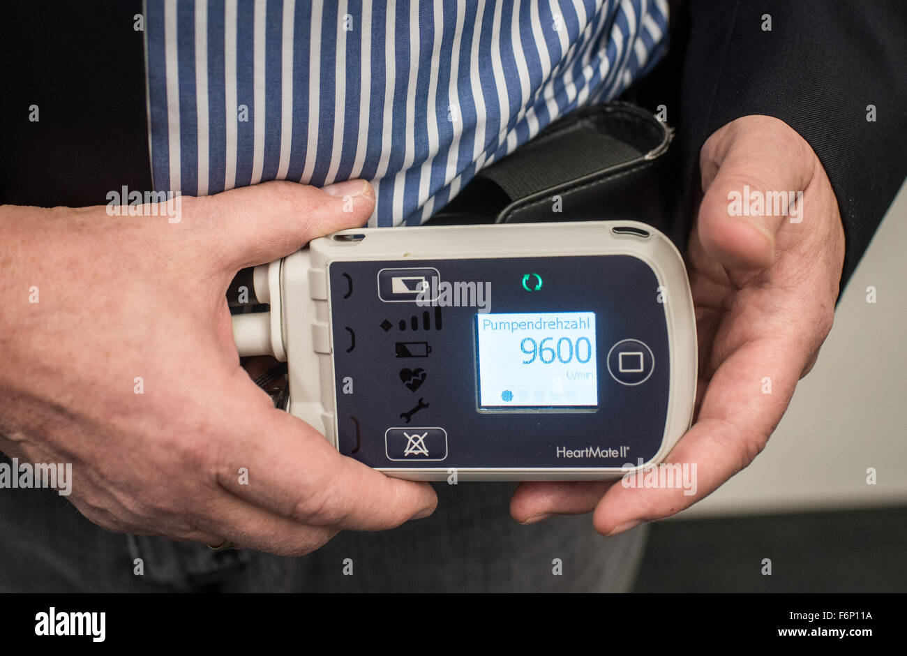 Herz Patient Uwe Schulz auf einer Pressekonferenz in der medizinischen Schule (MHH) in Hannover (Niedersachsen), halten die ventricular Assist Devices, "HeartMate II" in der Hand, Hannover, Deutschland, 18. November 2015. Schulz lebt seit zehn Jahren mit dem künstlichen Herzen, er ist ein laut, der MHH der europäische Rekordhalter. Foto: OLE SPATA/dpa Stockfoto