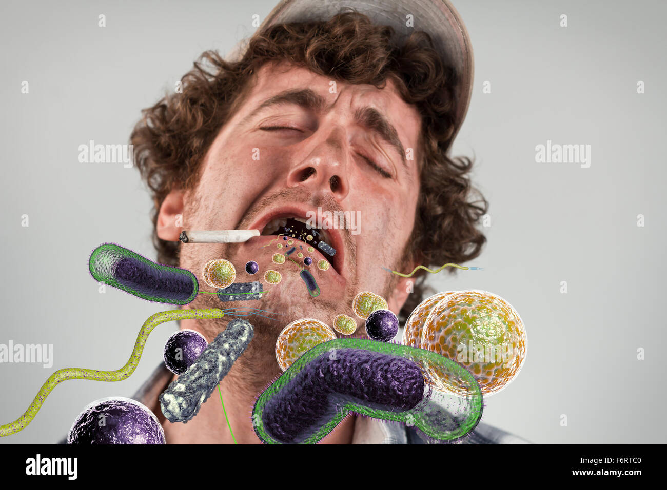 Bakterien-Virus-Krankheit krank Rednecks offenem Mund ausgießen Stockfoto