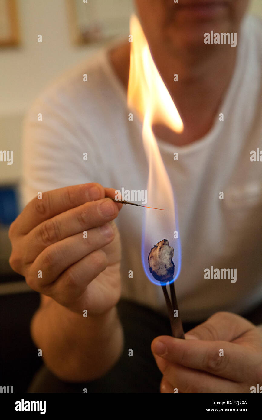 Reportage über einen Therapeuten, der in der traditionellen chinesischen Medizin spezialisiert ist. Der Therapeut vereint Nadeln und Moxibustion, die Nadeln Heizung ermöglicht die Akupunkturpunkte stimuliert zu werden mehr Stockfoto