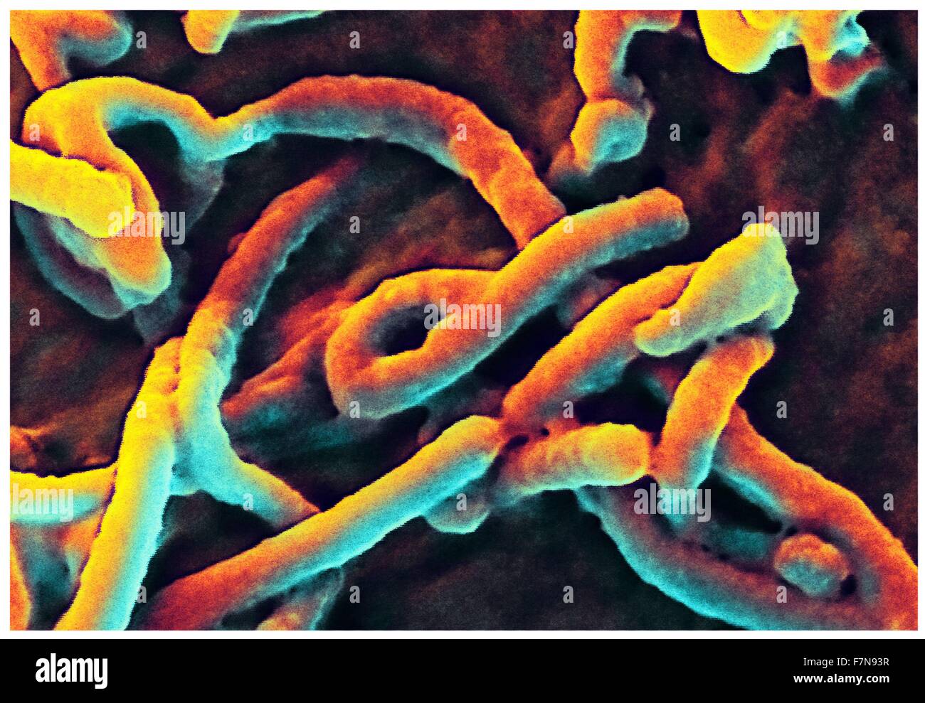 Produziert vom nationalen Institut der Allergie und Infektionskrankheiten (NIAID), unter einem sehr hohen Vergrößerung, diese Digital-eingefärbte Scanning Electron Micrograph (SEM) schildert filamentösen Ebola virus angehende Partikel von der Oberfläche einer Vero Zelle der afrikanischen grünen Affen Niere Epithelzellen. Stockfoto