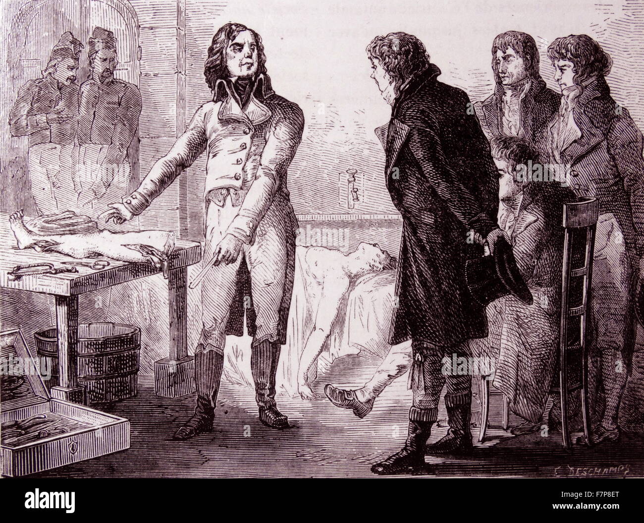 Dominique Jean LARREY - 1766-1842French Militärarzt: ging mit Napoleon nach Ägypten im Jahr 1798. Große Geschwindigkeit bei Amputation (13-15 Sekunden für ein Bein). Hier gezeigten Muskelkontraktionen in einem vor kurzem amputierten Gliedmaßen durch galvanische Effekte zeigen. Stockfoto