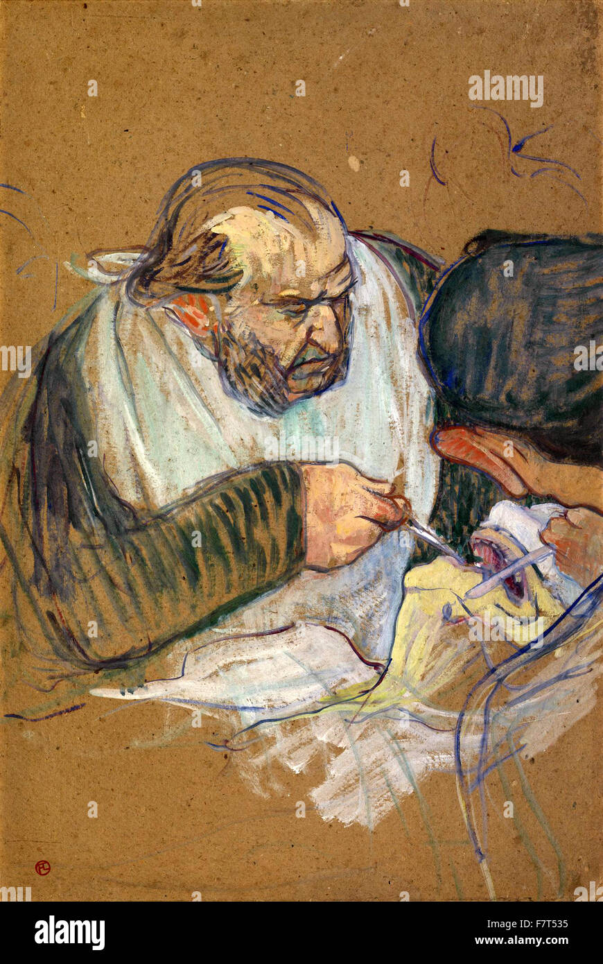 Henri de Toulouse-Lautrec-Dr. Péan Operating Stockfoto