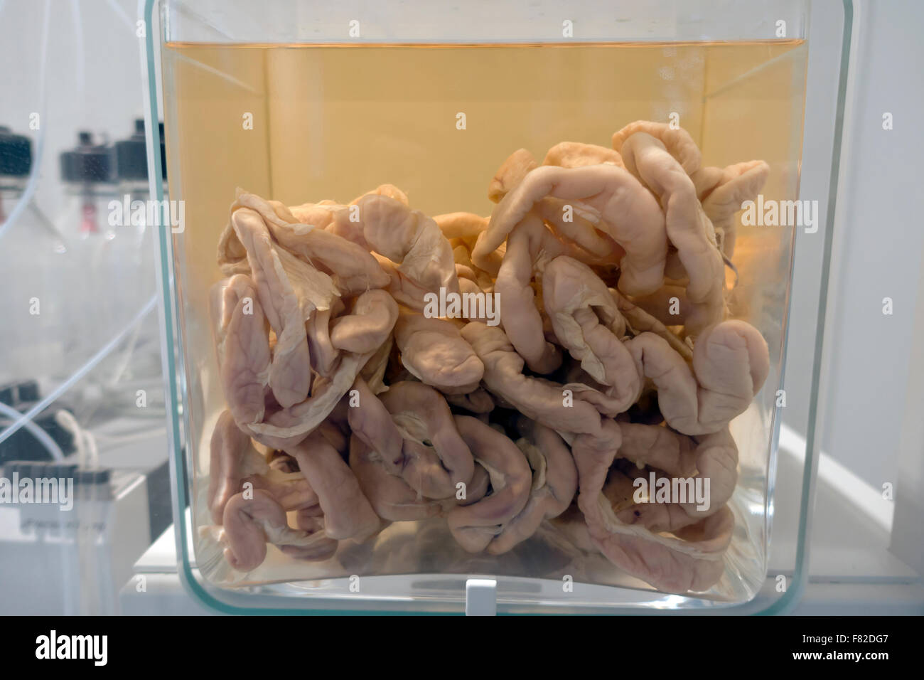 Ursprünglichen menschlichen Darm und Darmsystem Exemplar in Formalin Glas erhalten. Medizinische Museion, Kopenhagen, Dänemark. Stockfoto
