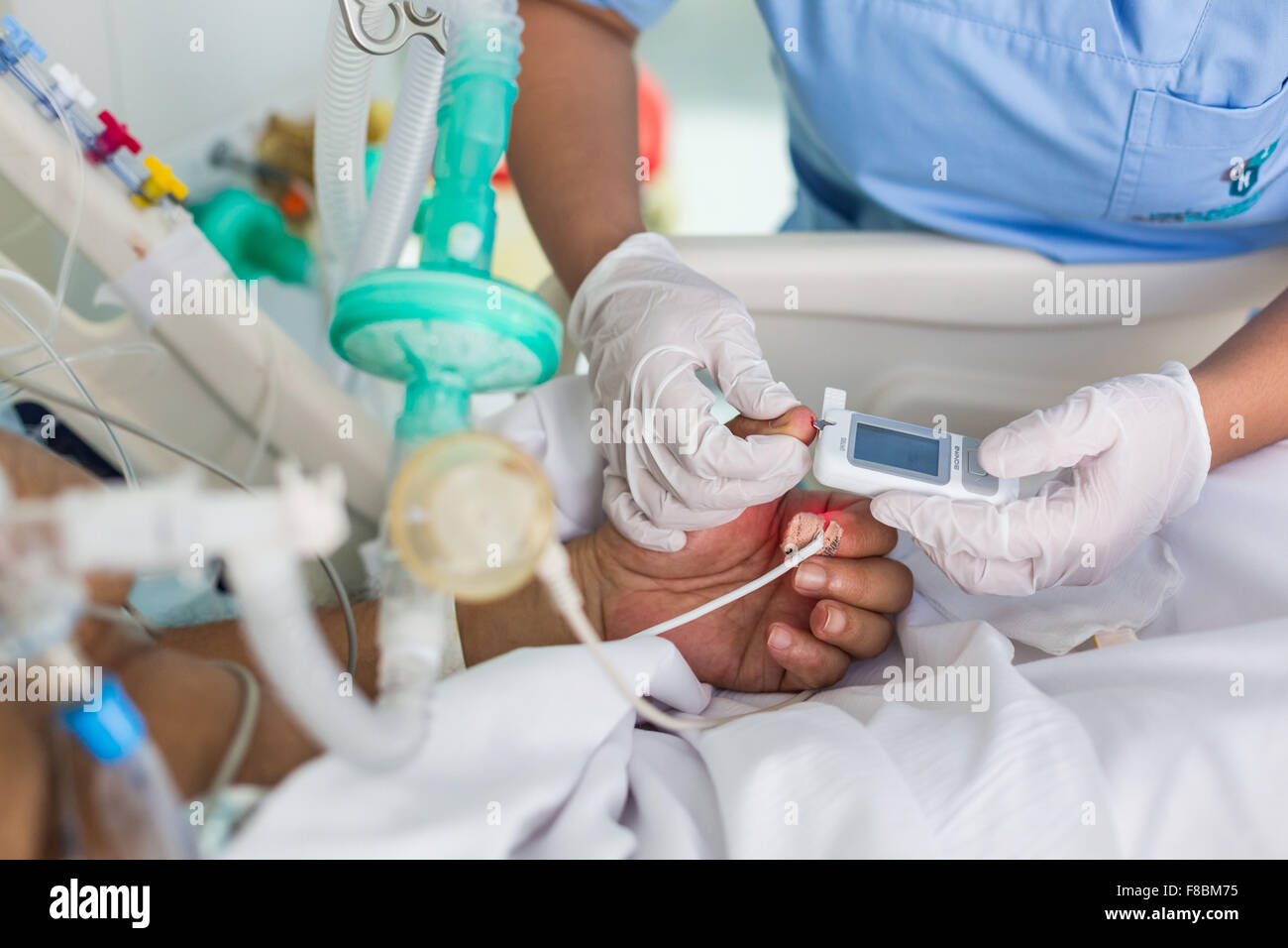 Blutzuckermessung eines Patienten im Krankenhaus auf der Intensivstation unter Unterstützung der Atmung. Intensivmedizin-Abteilung. Stockfoto