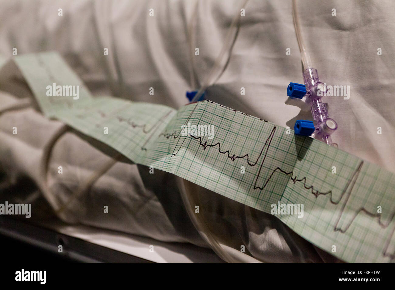 Heart Rate Monitor Klebeband auf medizinische ausdrucken Band - USA Stockfoto