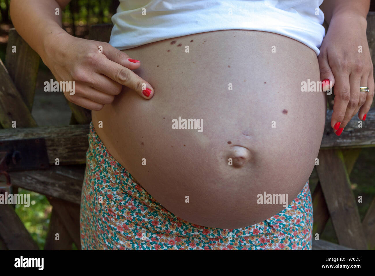Schwangere Frau und ihr Bauch riesig Stockfoto