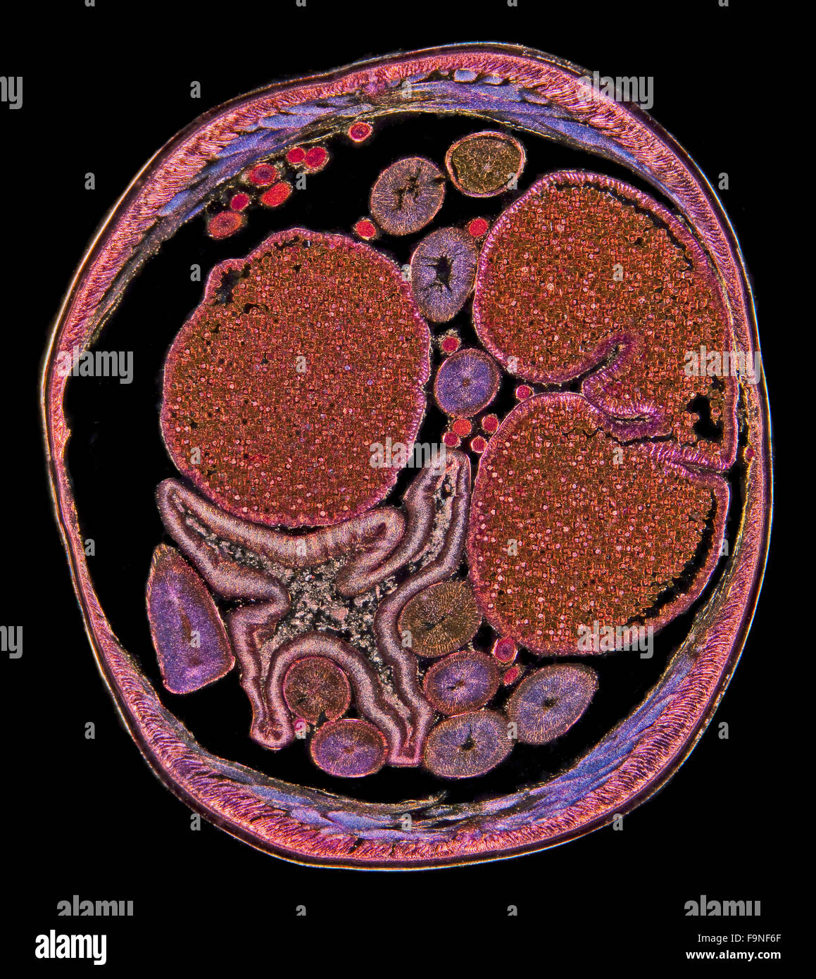 Dunkelfeld Mikrophotographie des Wurms Nematoda Ascaris TS weiblich, zeigt allgemeine Struktur Stockfoto