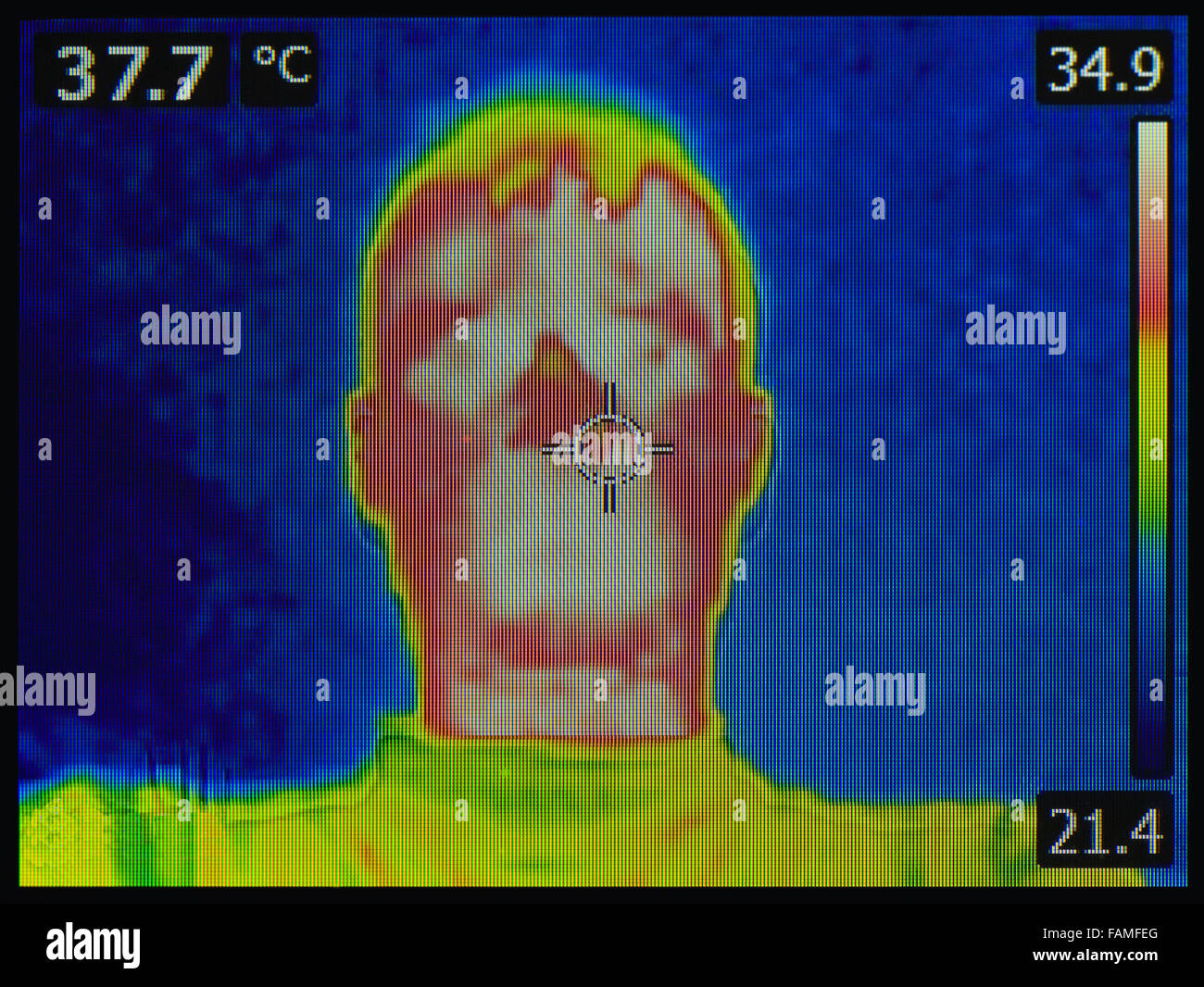 Hot Fever Wärme Infrarot-Wärmebild Stockfoto