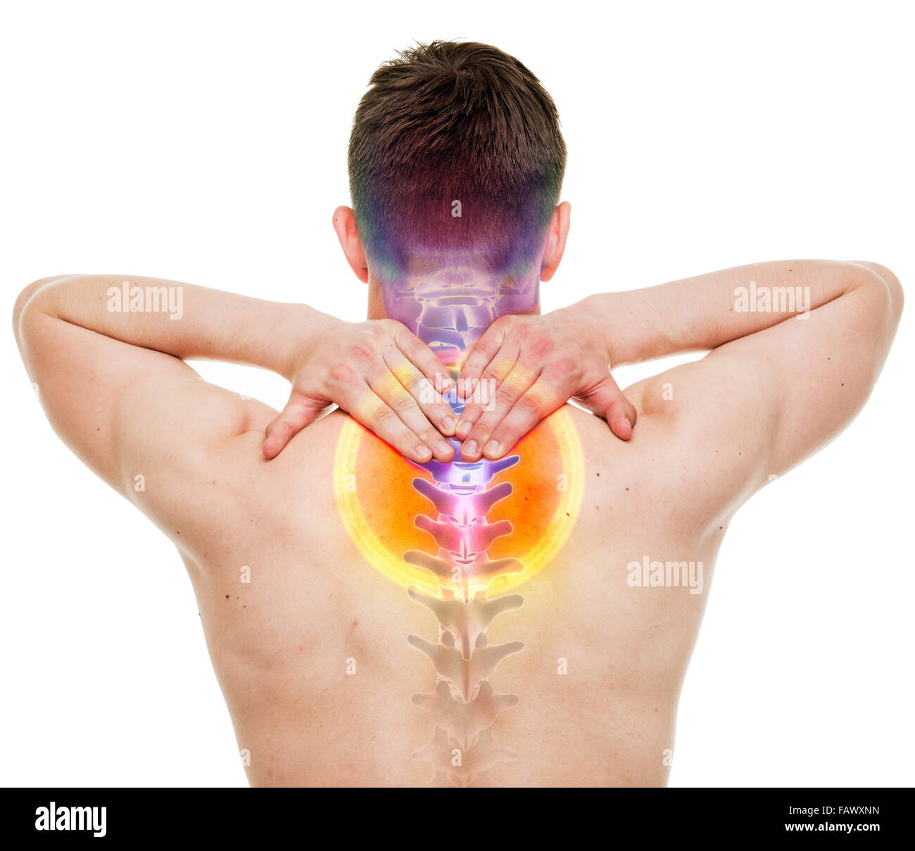 Nackenschmerzen - männliche verletzt Halswirbelsäule isoliert auf weiss - echter Anatomie-Konzept Stockfoto