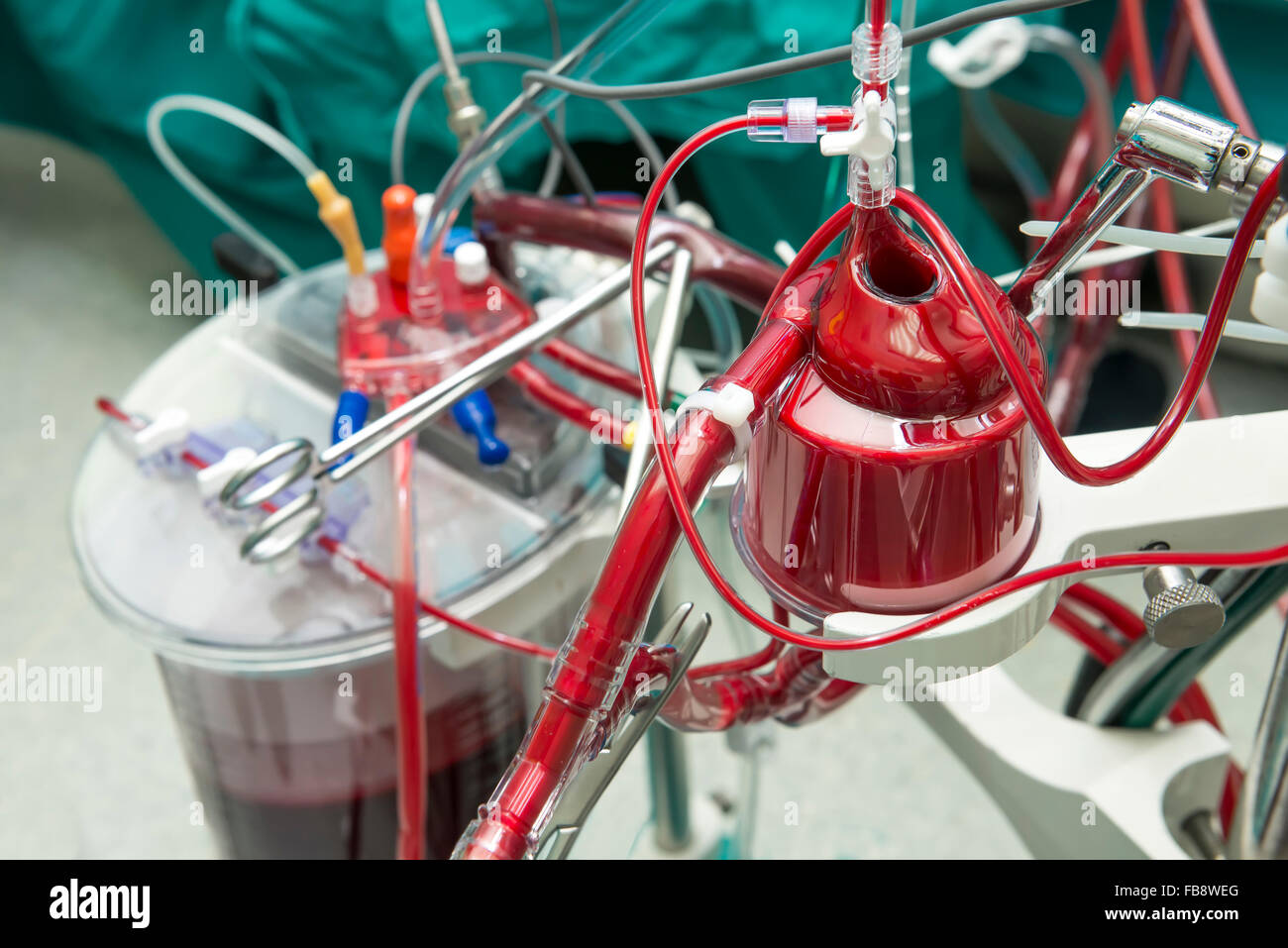 Blut Filtern auf extrakorporalen Maschine Durring die Operation am offenen Herzen Stockfoto