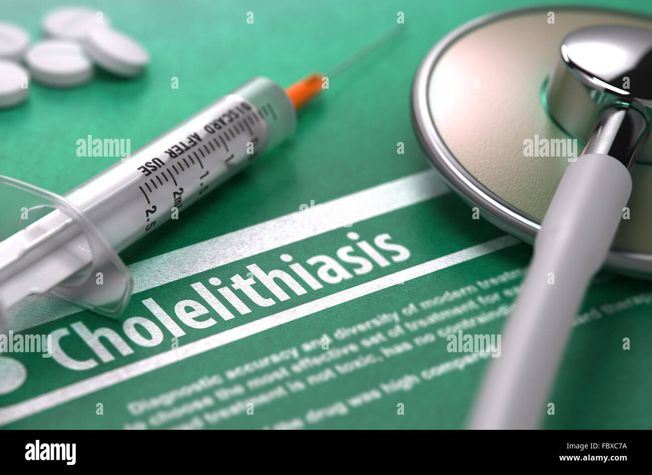 Diagnose - Cholelithiasis. Medizinisches Konzept. Stockfoto