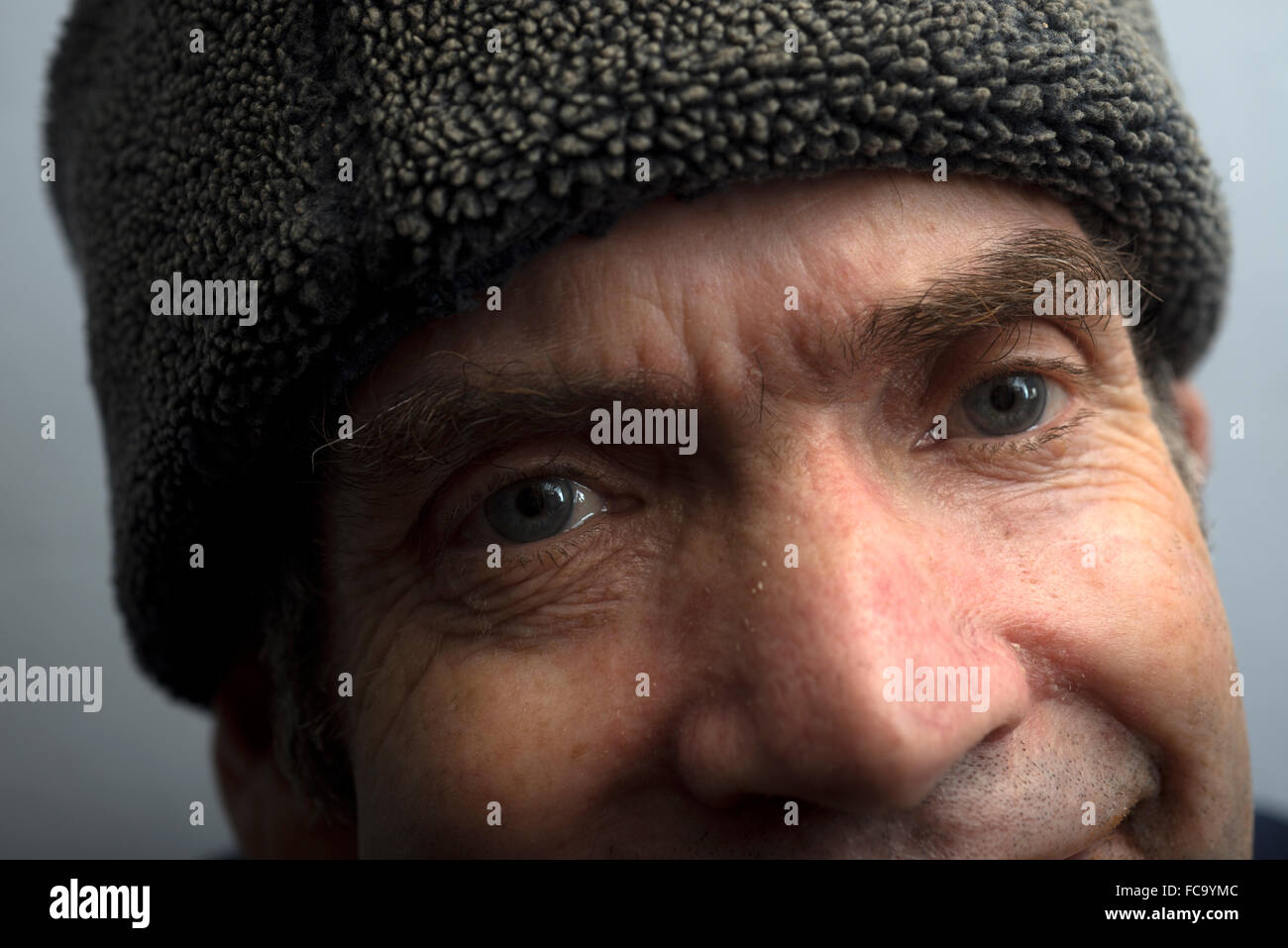 Mann mit Metall gesundheitlichen Problemen Leben mit inoperablem Kehlkopfkrebs Stockfoto