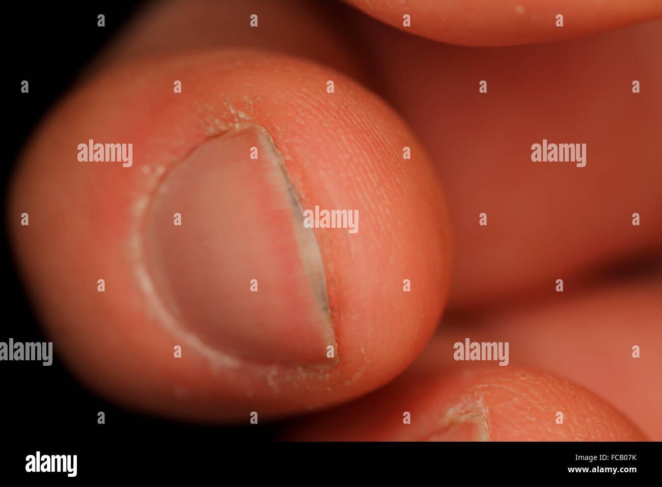 Fingerspitze zeigt schmutzige Fingernägel. Stockfoto