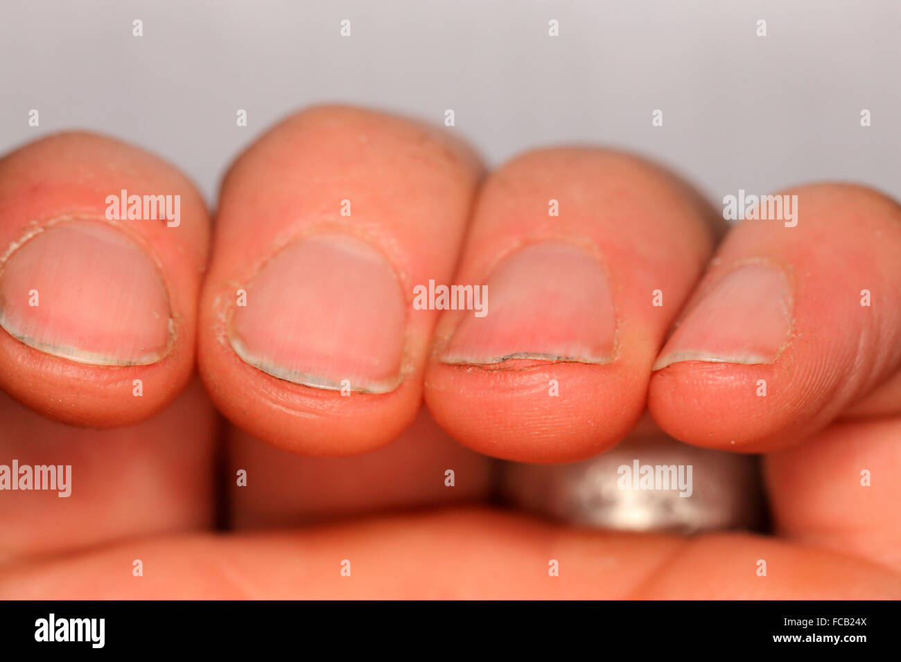 Finger Nail Fotos Und Bildmaterial In Hoher Aufl sung Alamy