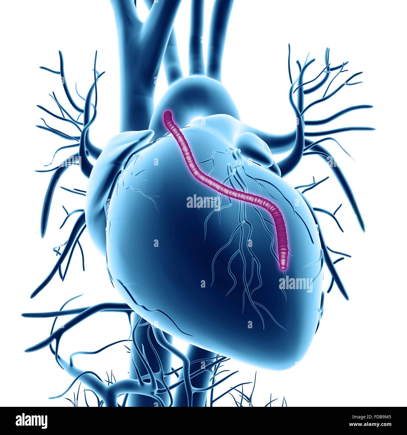 Herz-Bypass Graft. Computer Grafik eines Herzens, das eine Verstopfung der Herzkranzgefäße behandelt durch Koronararterie gehabt hat bypass Graft (CABG) Chirurgie. Die Herzkranzgefäße sind die kleinen Blutgefäße gesehen läuft über die äußere Oberfläche des Herzens. Sie liefern sauerstoffreiches Blut zu halten das Herz Muskel pumpt, und eine Blockade kann einen tödlichen Herzinfarkt. Die Lösung besteht darin, Arterien von anderswo ernten im Körper und nutzen sie, um die Blockade zu umgehen. Ein Transplantat ist gesehen laufen aus der Aorta, der Hauptteil Arterie zurück an den Herzkranzgefäßen. Stockfoto