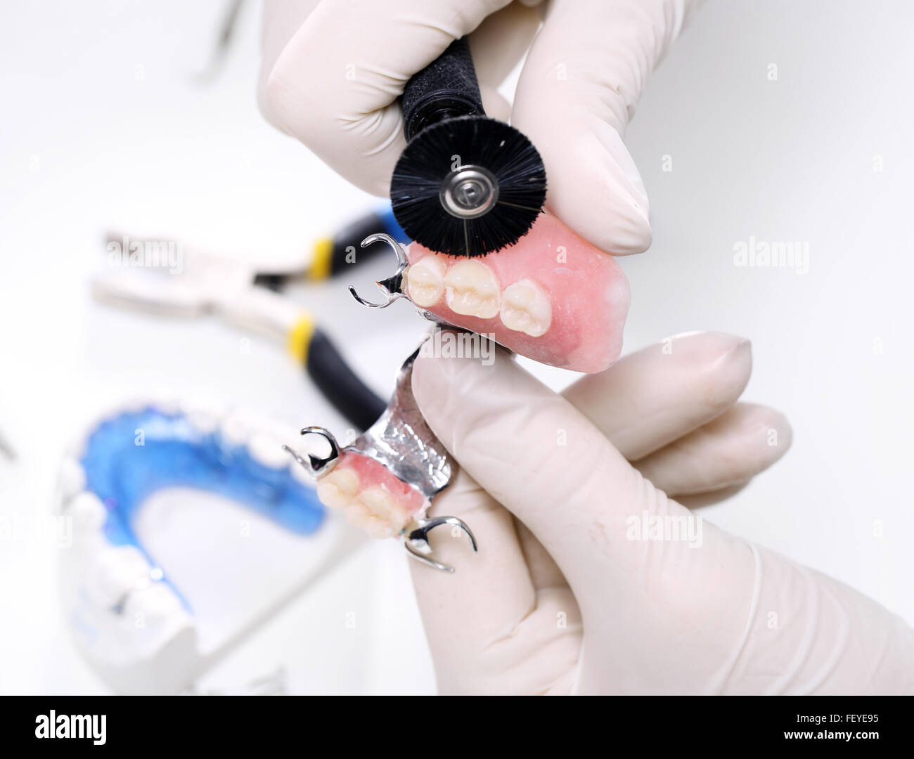 Teilprothesen auf einem Metall Bogen. Teilprothesen, Dental und Prothetik Stockfoto