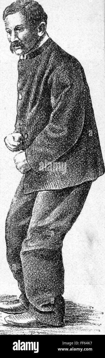 Medizin, Krankheiten, Parkinson-Krankheit, typische Pose eines Kranken, Holzstich, um 1900, zusätzliche-Rechte-Clearenzen-nicht vorhanden Stockfoto