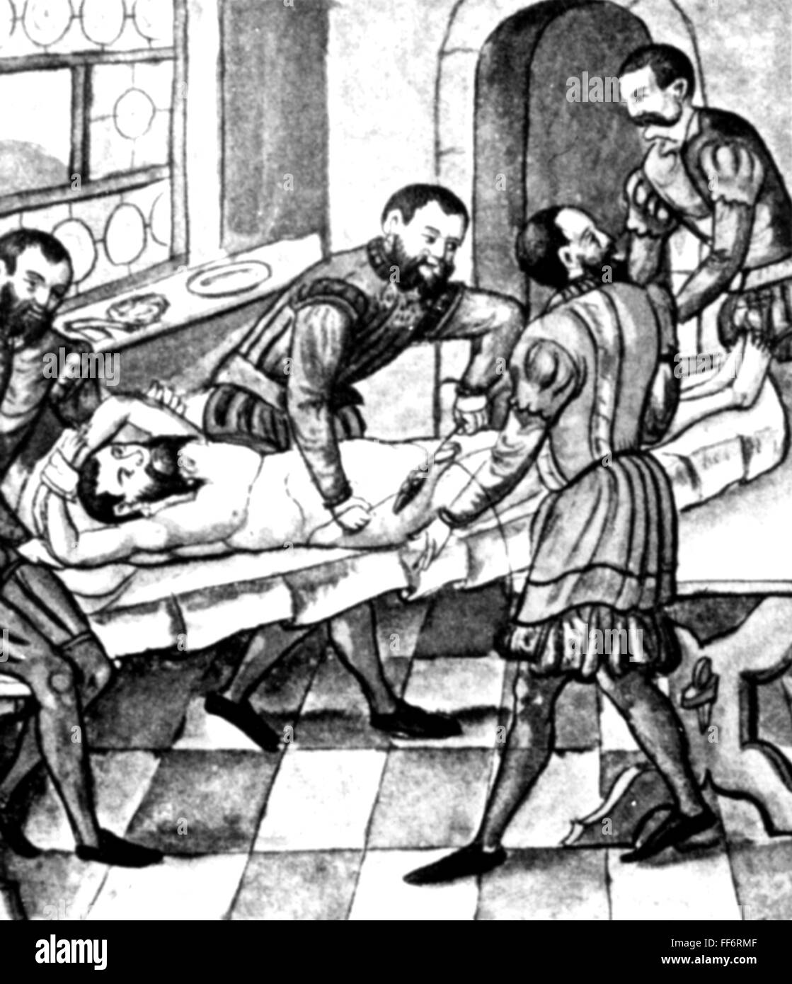 Medizin, Chirurgie, Hernie, aus: Caspar Stromayr (+ 1566 / 1567), 'Practica copiosa', Lindau, 1559, Additional-Rights-Clearences-not available Stockfoto