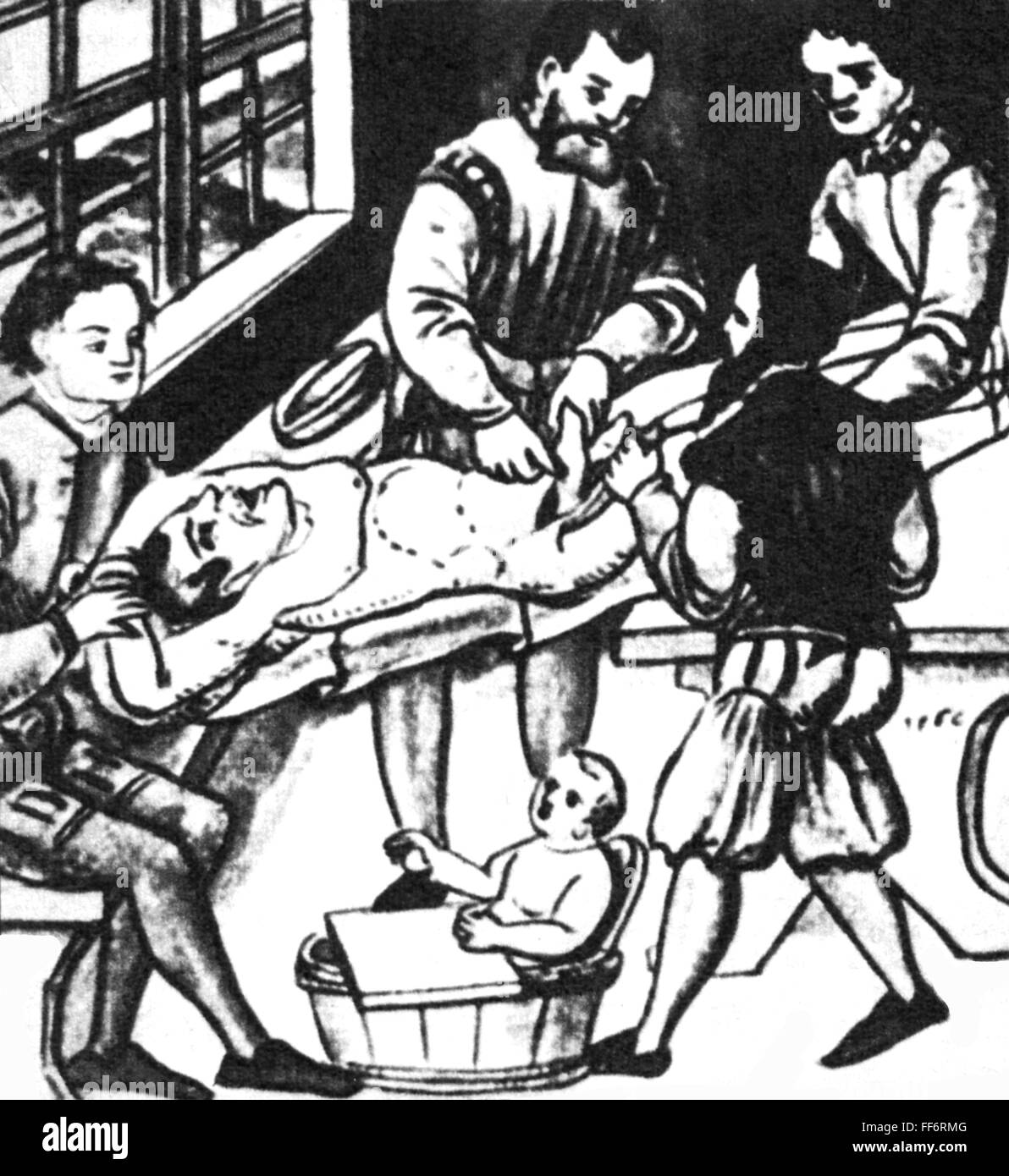 Medizin, Chirurgie, Hernie, aus: Caspar Stromayr (+ 1566 / 1567), 'Practica copiosa', Lindau, 1559, Additional-Rights-Clearences-not available Stockfoto