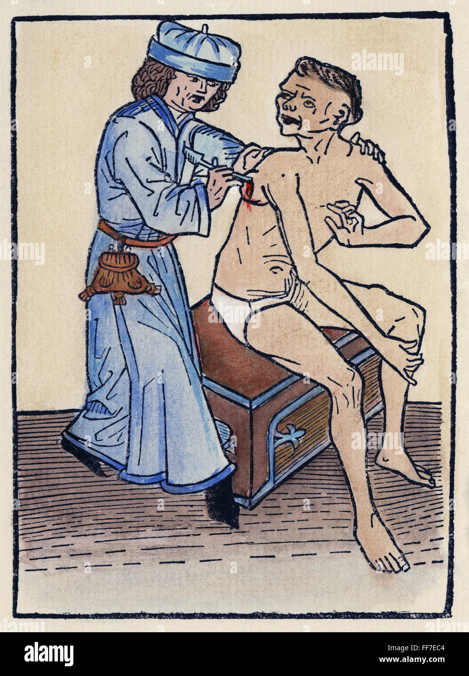 PEST ARZT, 1482. NUM Arzt Stechhilfe eine Pest verursacht Bubo, die wahrscheinlich die Wahrscheinlichkeit erhöht der Verbreitung der Seuche. Deutsche Holzschnitt, 1482. Stockfoto
