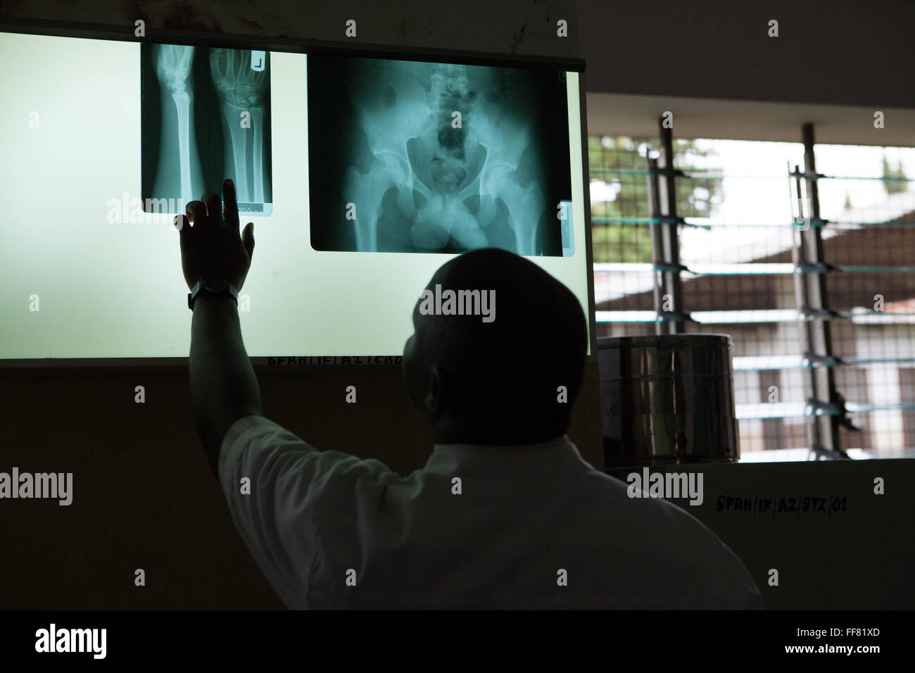 Ein Arzt, der Blick auf eine X ray auf einem Leuchttisch am St. Francis Hospital in Ifakara, Tansania. Stockfoto
