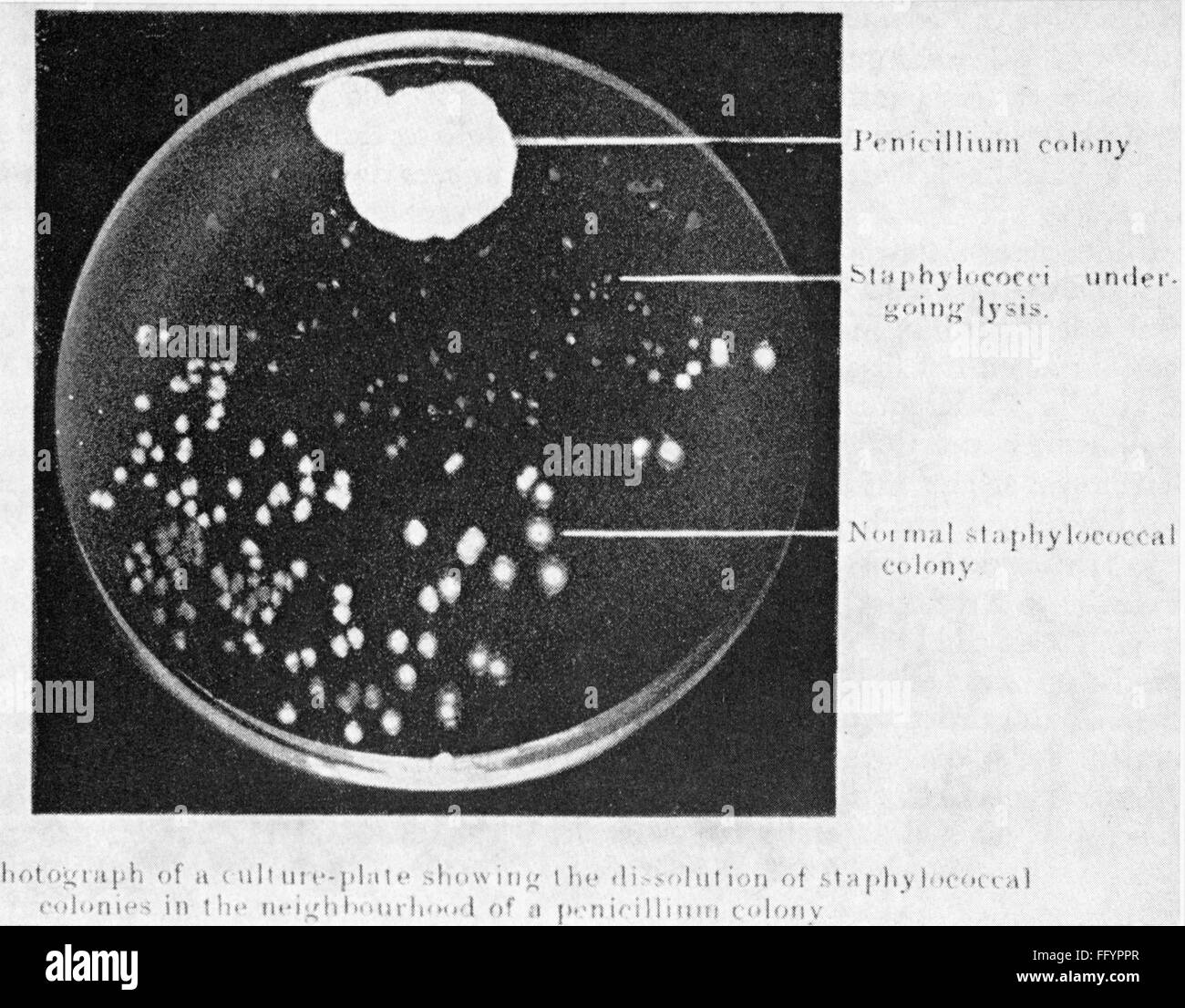 Medizin, Arzneimittel, Penicillin, penicillium und Staphylokokken, Original-Nährlösung von Alexander Fleming (1881 - 1955), 28.9.1928, Zusatz-Rechteklärung-nicht vorhanden Stockfoto