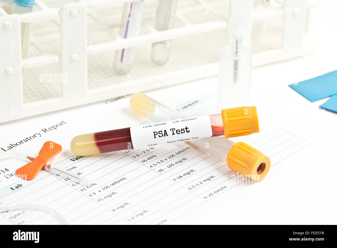 PSA-Analyse Sammelröhrchen mit Blut Sammlung Lieferungen und Bericht. Stockfoto
