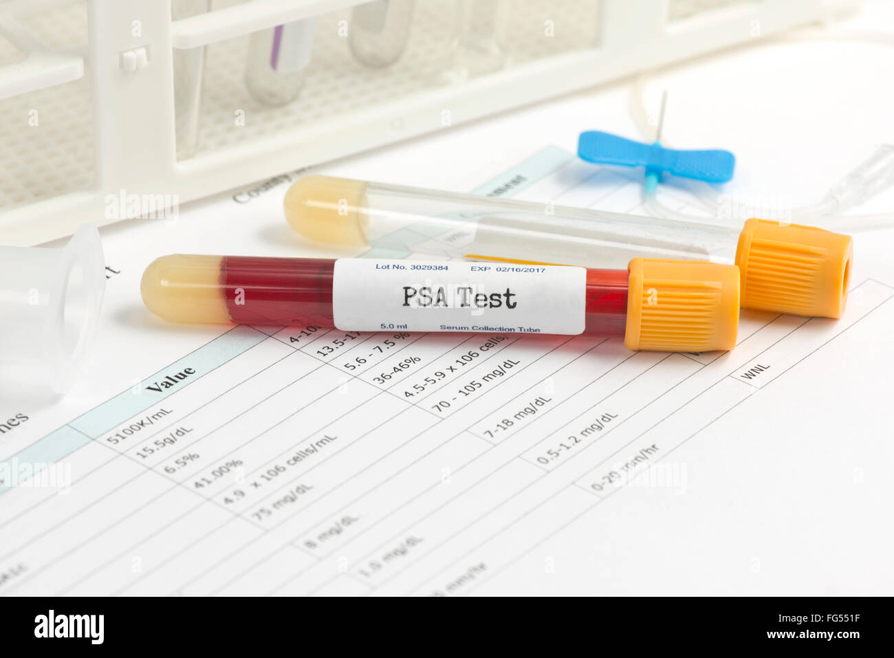 PSA-Analyse Sammelröhrchen mit Blut Sammlung Lieferungen und Bericht. Stockfoto