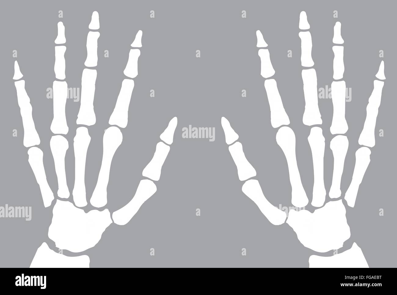 Die Knochen der Hand Röntgen isoliert auf weißem Hintergrund Stock Vektor