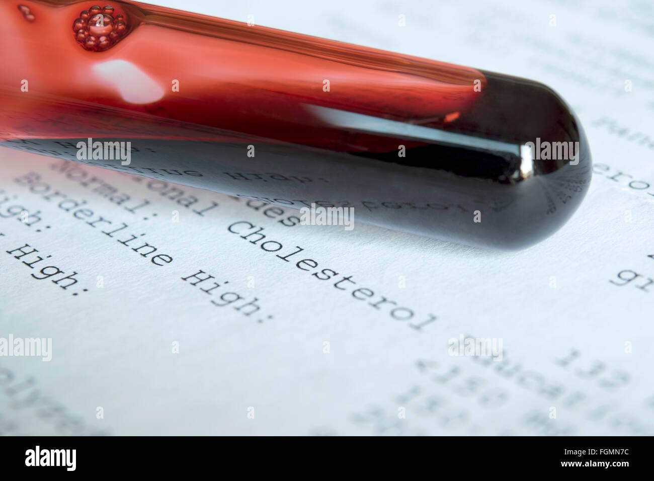 Reagenzglas Blut Cholesterin Testergebnisse Stockfoto