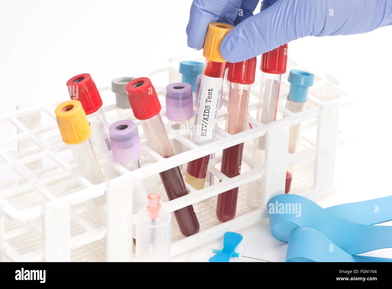 HIV Blut Analyse Sammelrohr von Laborantin ausgewählt.  Etiketten und Dokument sind frei erfunden und geschaffen von dem Foto Stockfoto