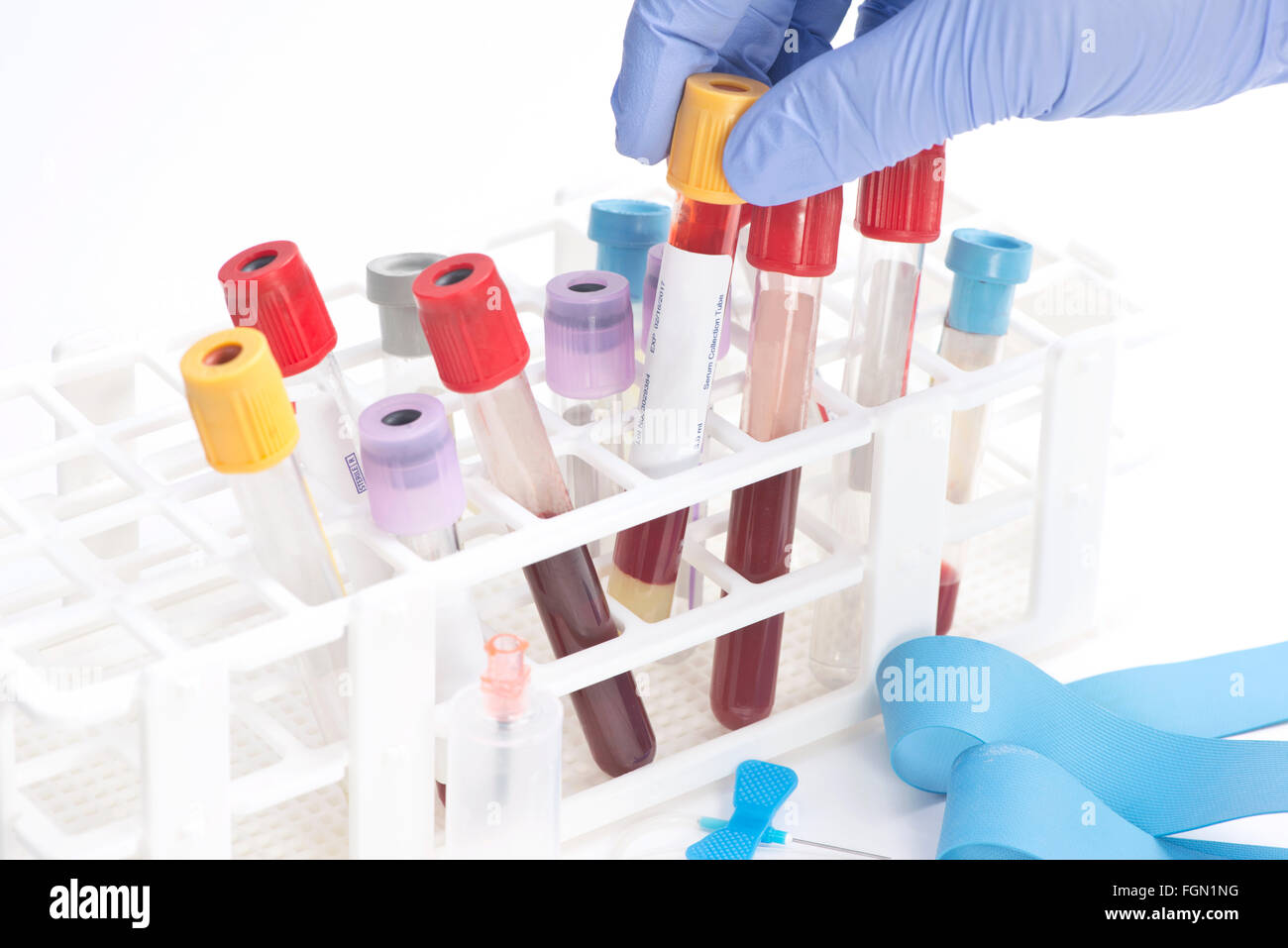 Blut-Analyse Sammelrohr von Laborantin ausgewählt.  Etiketten und Dokument sind fiktiv und vom Fotografen erstellt. Stockfoto