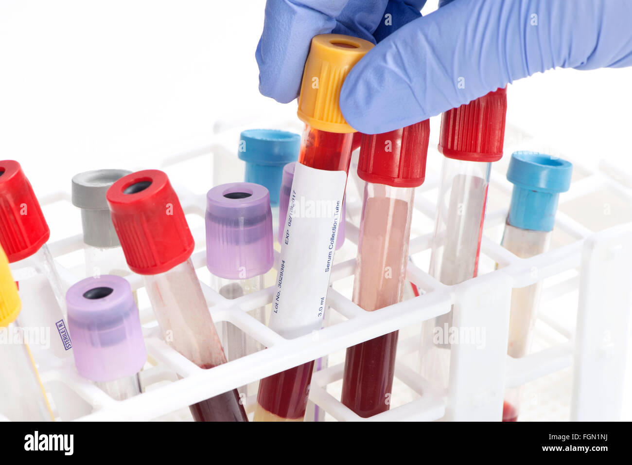 Blut-Analyse Sammelrohr von Laborantin ausgewählt.  Etiketten und Dokument sind fiktiv und vom Fotografen erstellt. Stockfoto