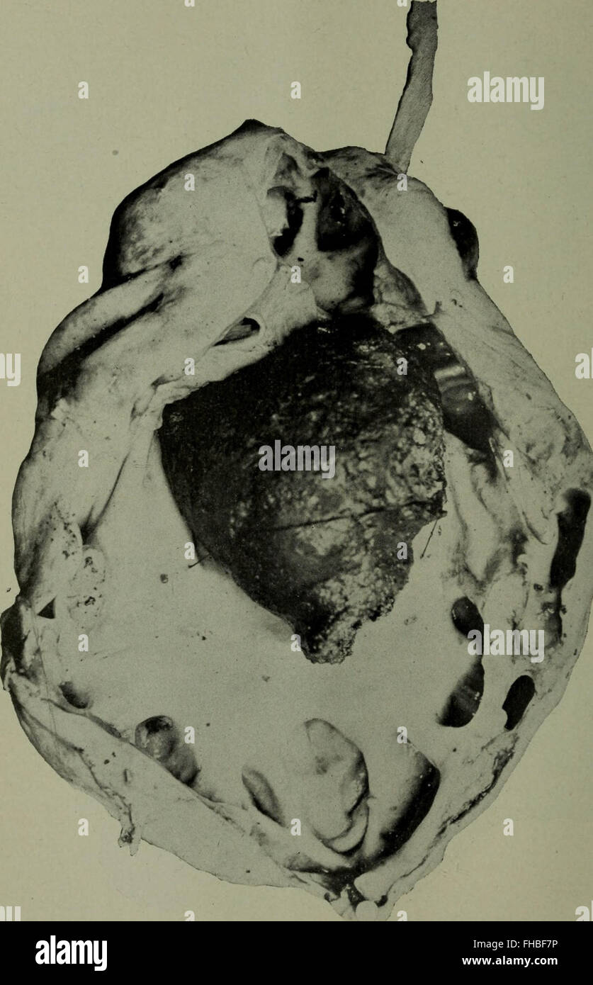 Das Cleveland medical Journal (1907) Stockfoto