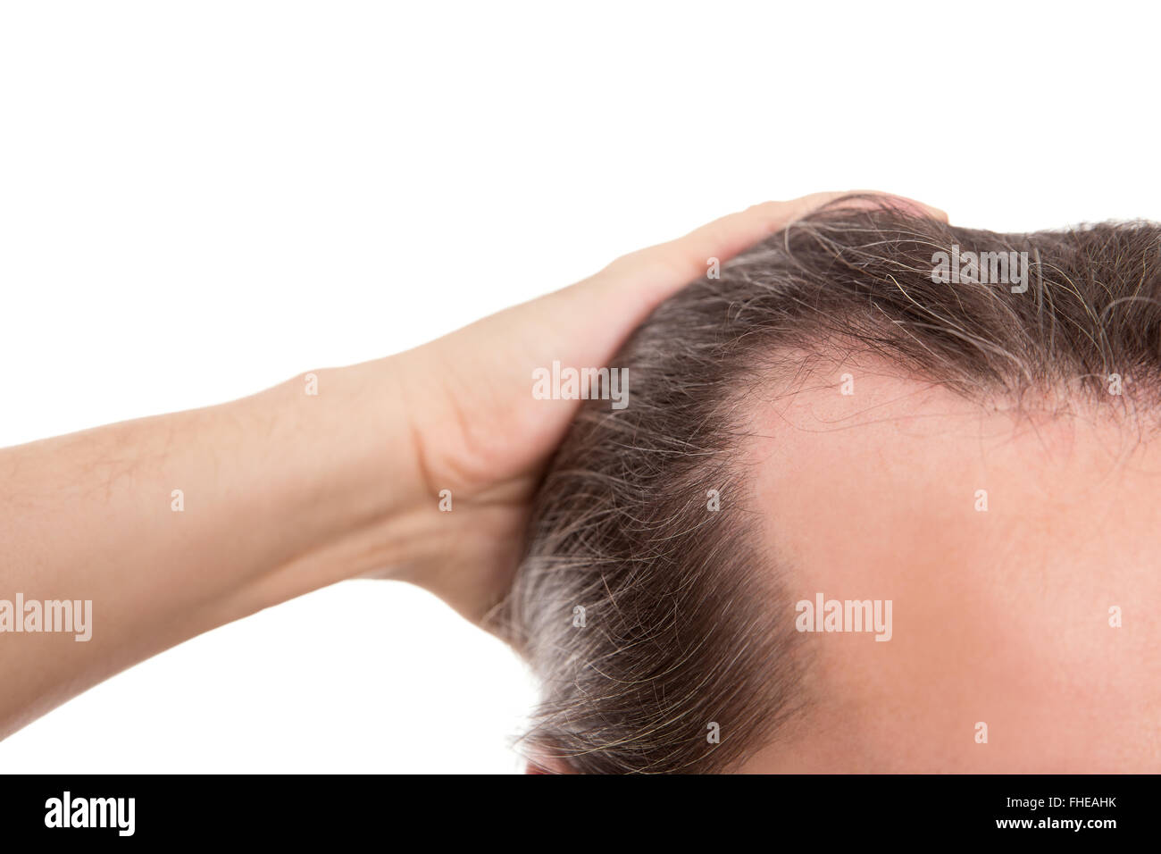 Mann mit Geheimratsecken, Nahaufnahme, isoliert auf weiß, Konzept Haarausfall und Glatzenbildung Stockfoto