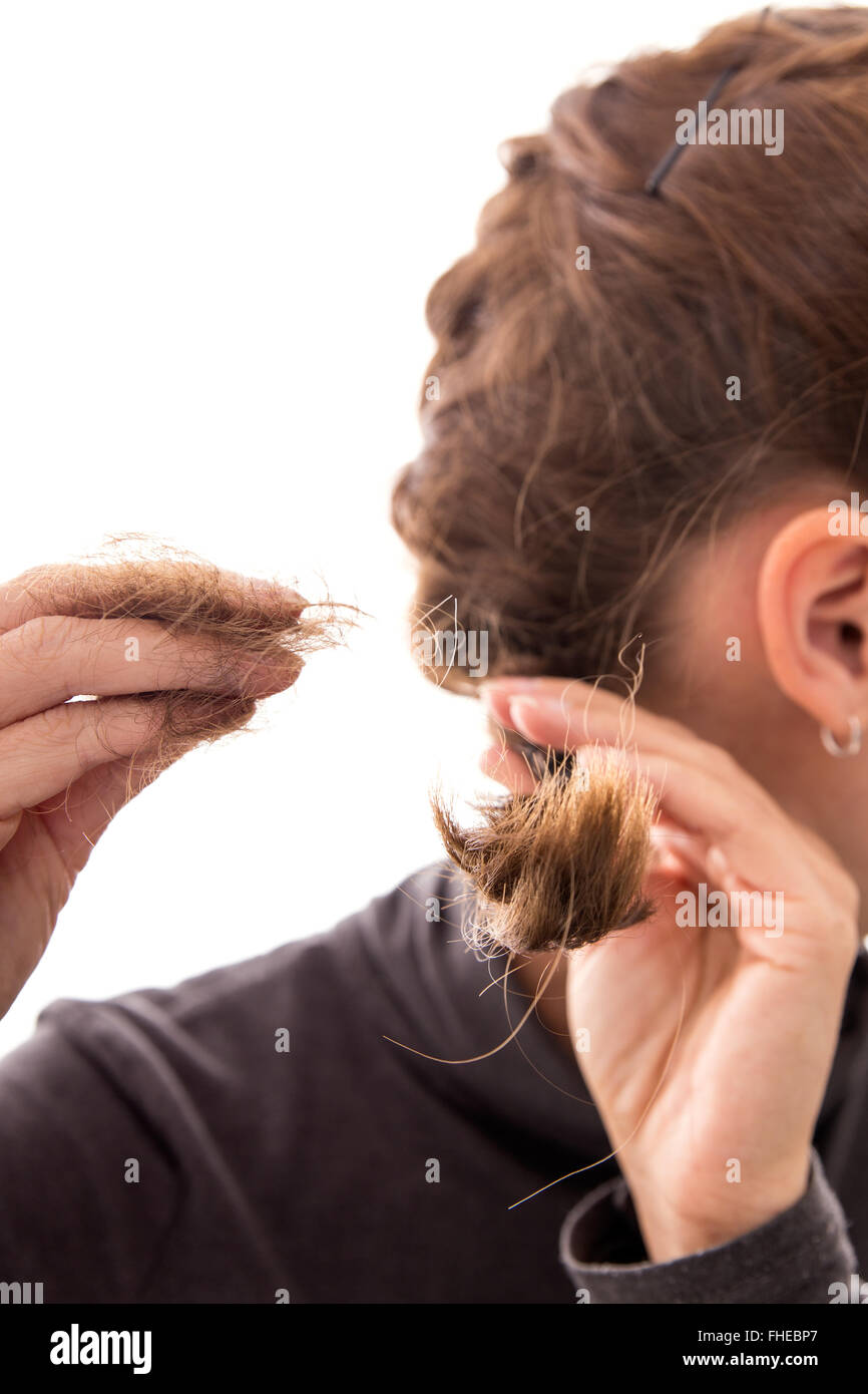 junge Frau mit Alopezie, Haarausfall Konzept über Hormone oder Mangel-Zeichen Stockfoto