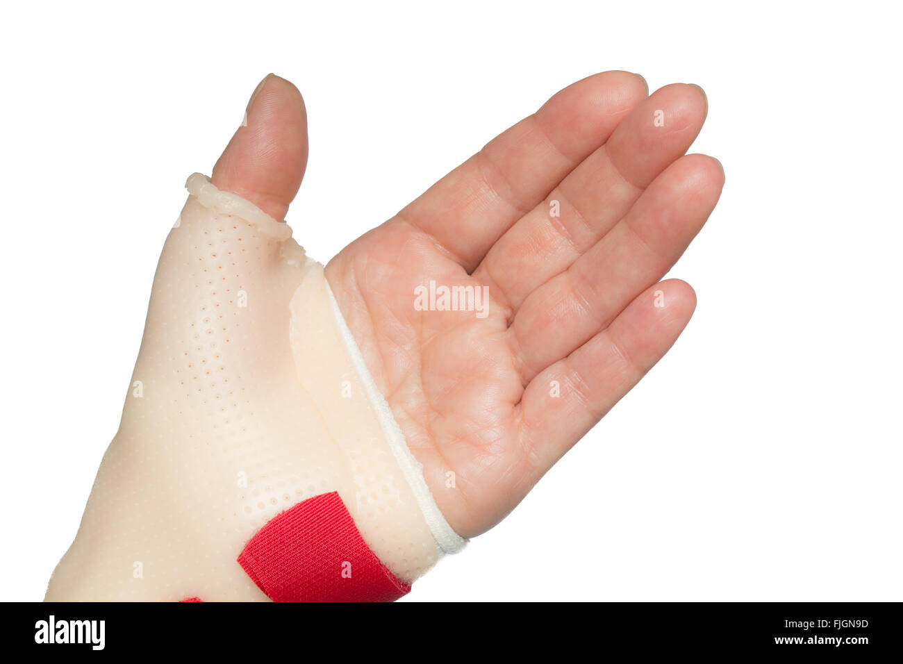 Linke Hand mit der Handfläche mit Handgelenk und Daumen splint Stockfoto