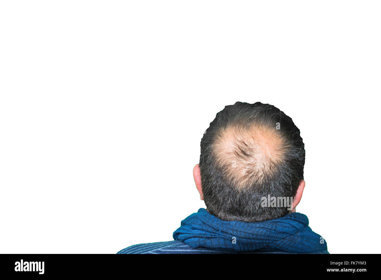 Reife Yang Mann, gesehen von hinten in den Kopf, Haare zu verlieren beginnt, beginnt er zu alt zu sein. Stockfoto