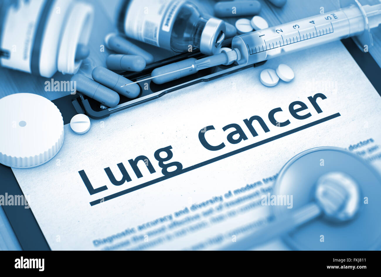 Lunge-Krebs-Diagnose. Medizinisches Konzept. Stockfoto