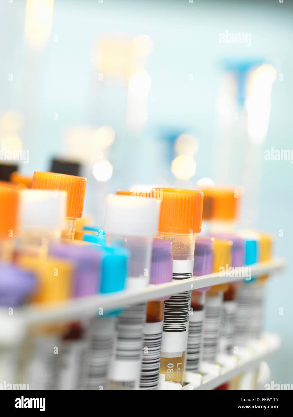 Blutprobe für medizinische Tests im Labor Stockfoto