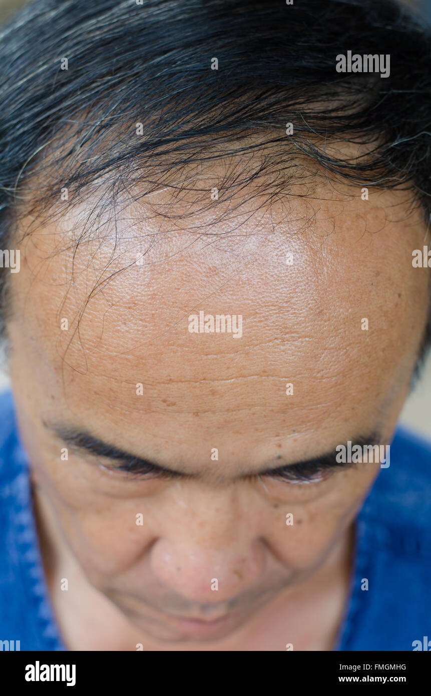 Glatze asiatischer Mann Stockfoto