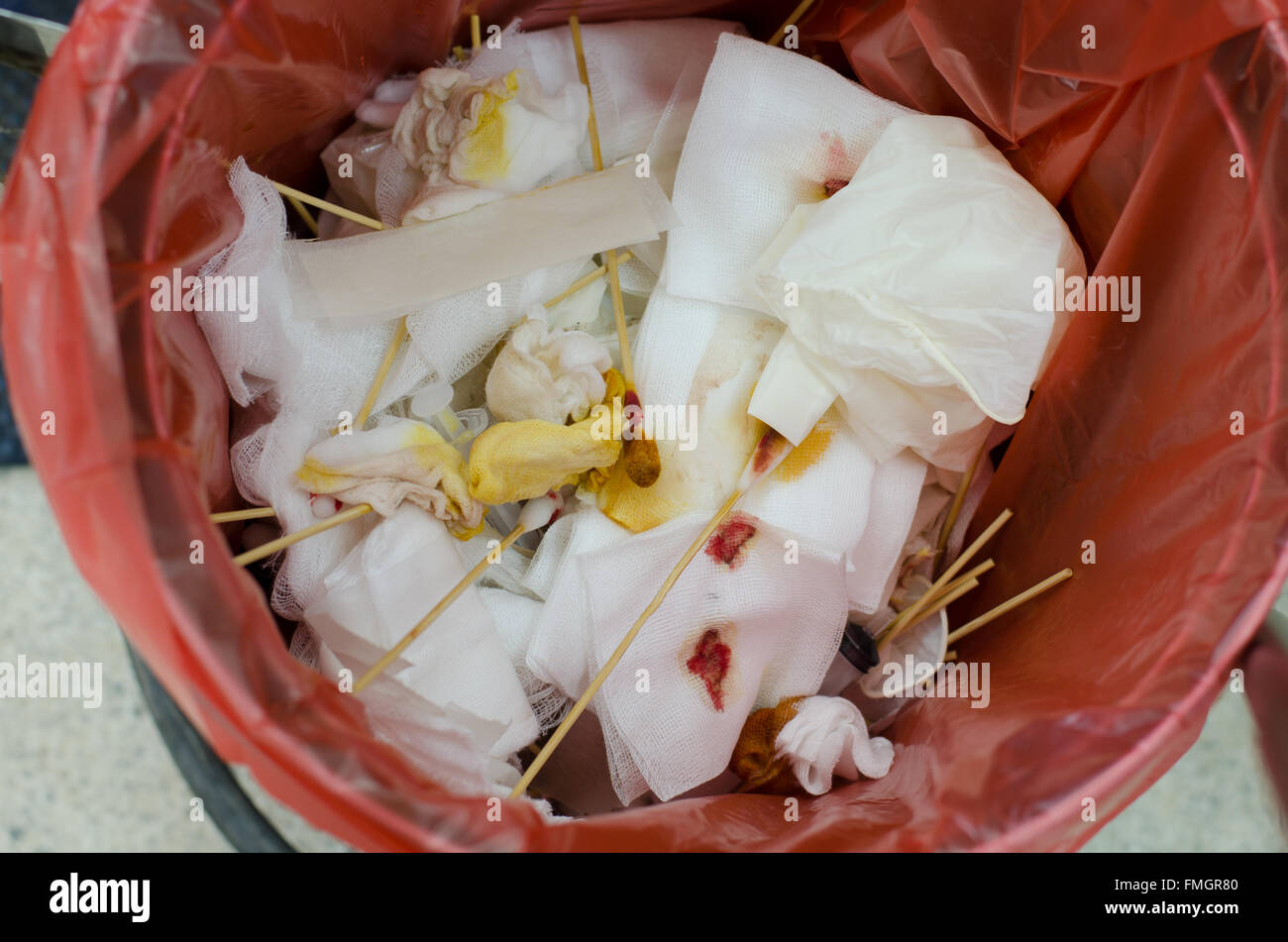 infektiöse Abfälle in rote Tasche Stockfoto