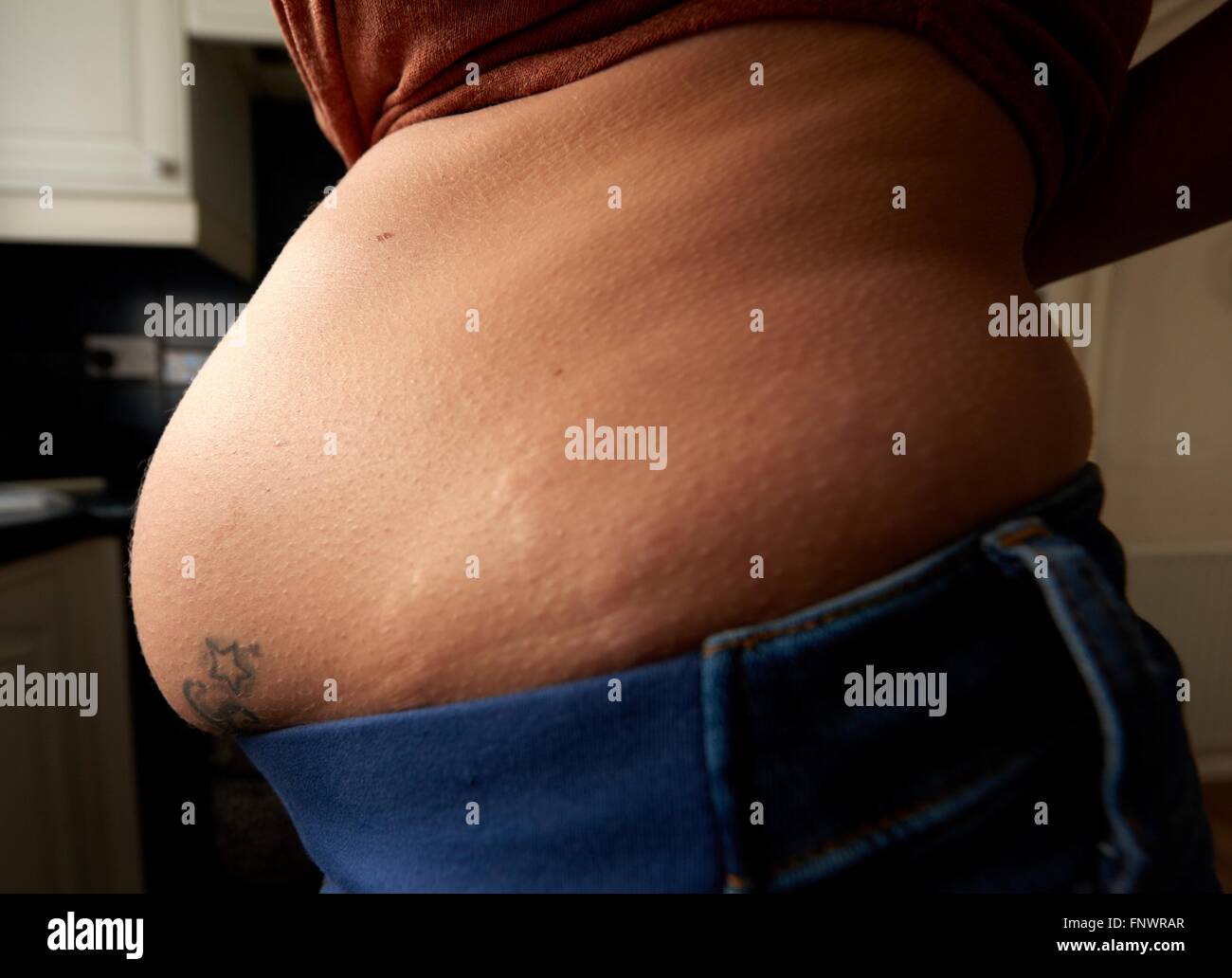 Dehnungsstreifen auf eine hochschwangere Frau England uk Stockfoto