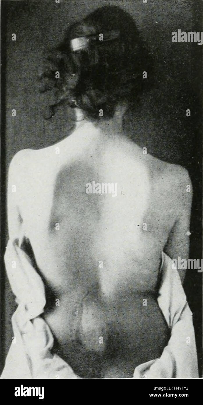 American Journal of Roentgenology, Radium-Therapie und Nuklearmedizin (1906) Stockfoto