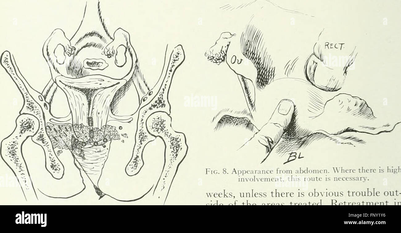 American Journal of Roentgenology, Radium-Therapie und Nuklearmedizin (1906) Stockfoto