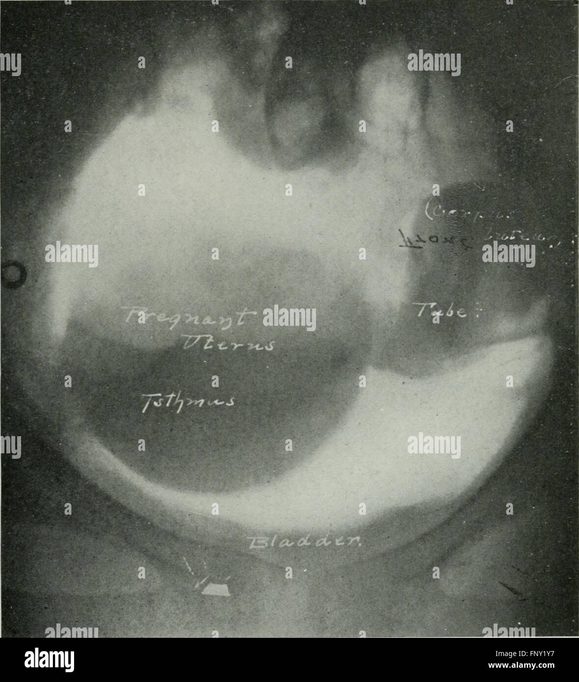 American Journal of Roentgenology, Radium-Therapie und Nuklearmedizin (1906) Stockfoto