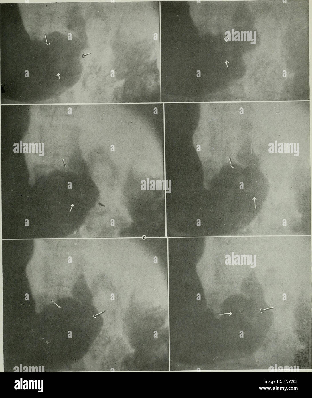 American Journal of Roentgenology, Radium-Therapie und Nuklearmedizin (1906) Stockfoto